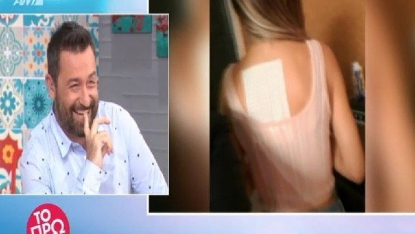 Πασίγνωστη τραγουδίστρια με έμπλαστρο στο Πρωινό του ΑΝΤ1 (ΒΙΝΤΕΟ)