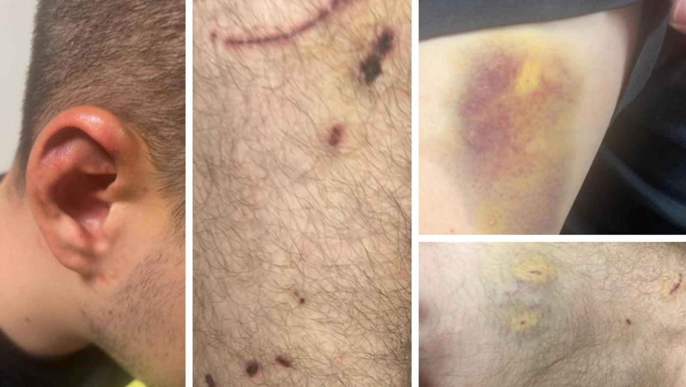 Ivan Greko-Φωτογραφίες ΣΟΚ: Τα σημάδια από τα άγρια βασανιστήρια στο σώμα του 24χρονου