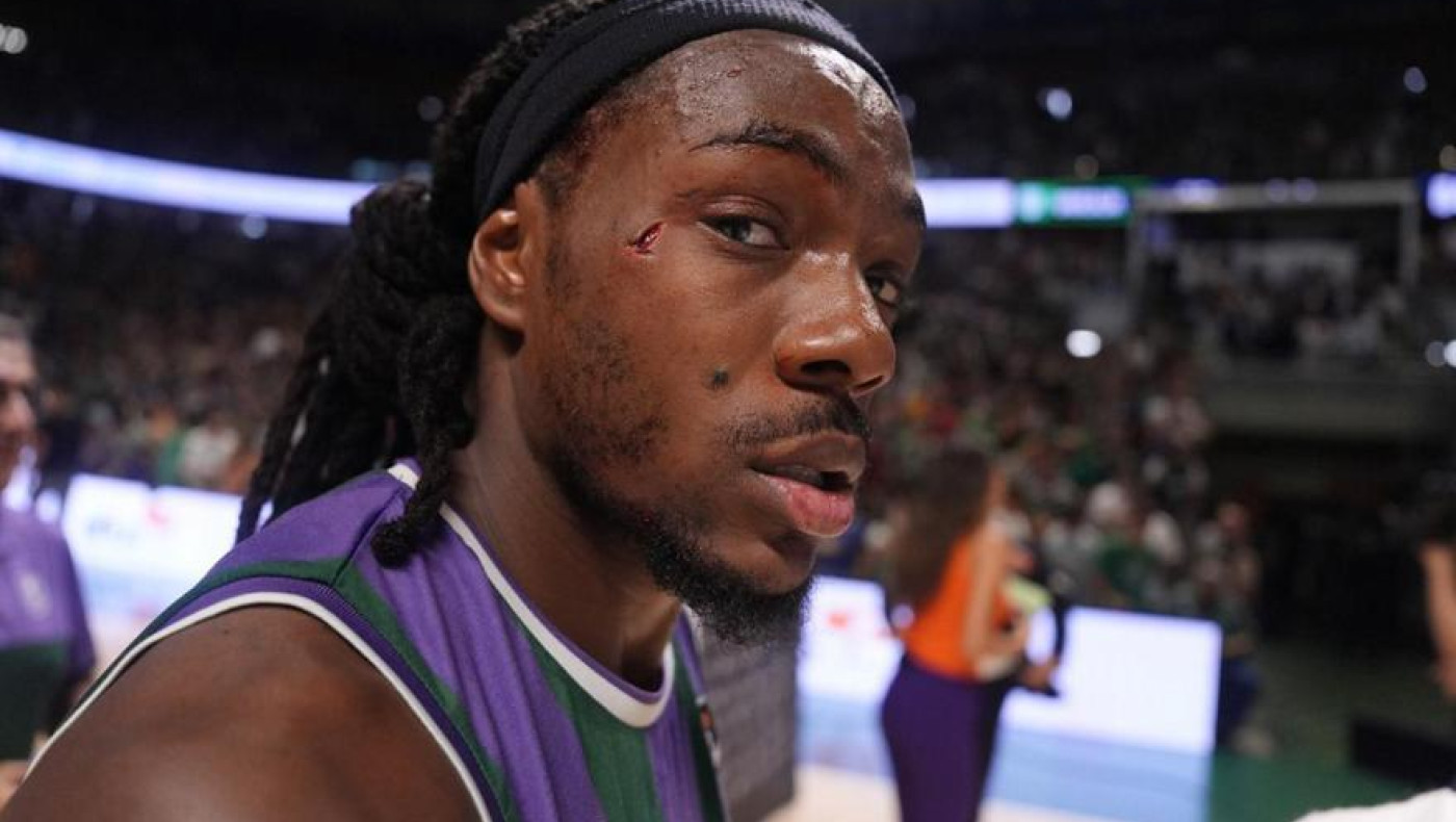 Ισπανία: Κέρδισε τη Ρεάλ και ένα βαθύ σκίσιμο στο πρόσωπο ο Πέρι