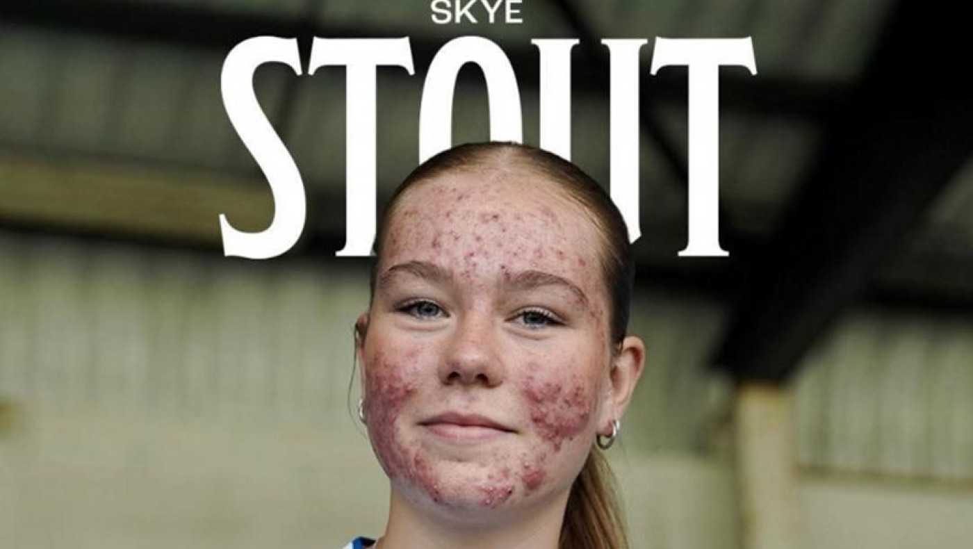 Κιλμάρνοκ: Παίκτρια έπεσε θύμα εκφοβισμού στα social media