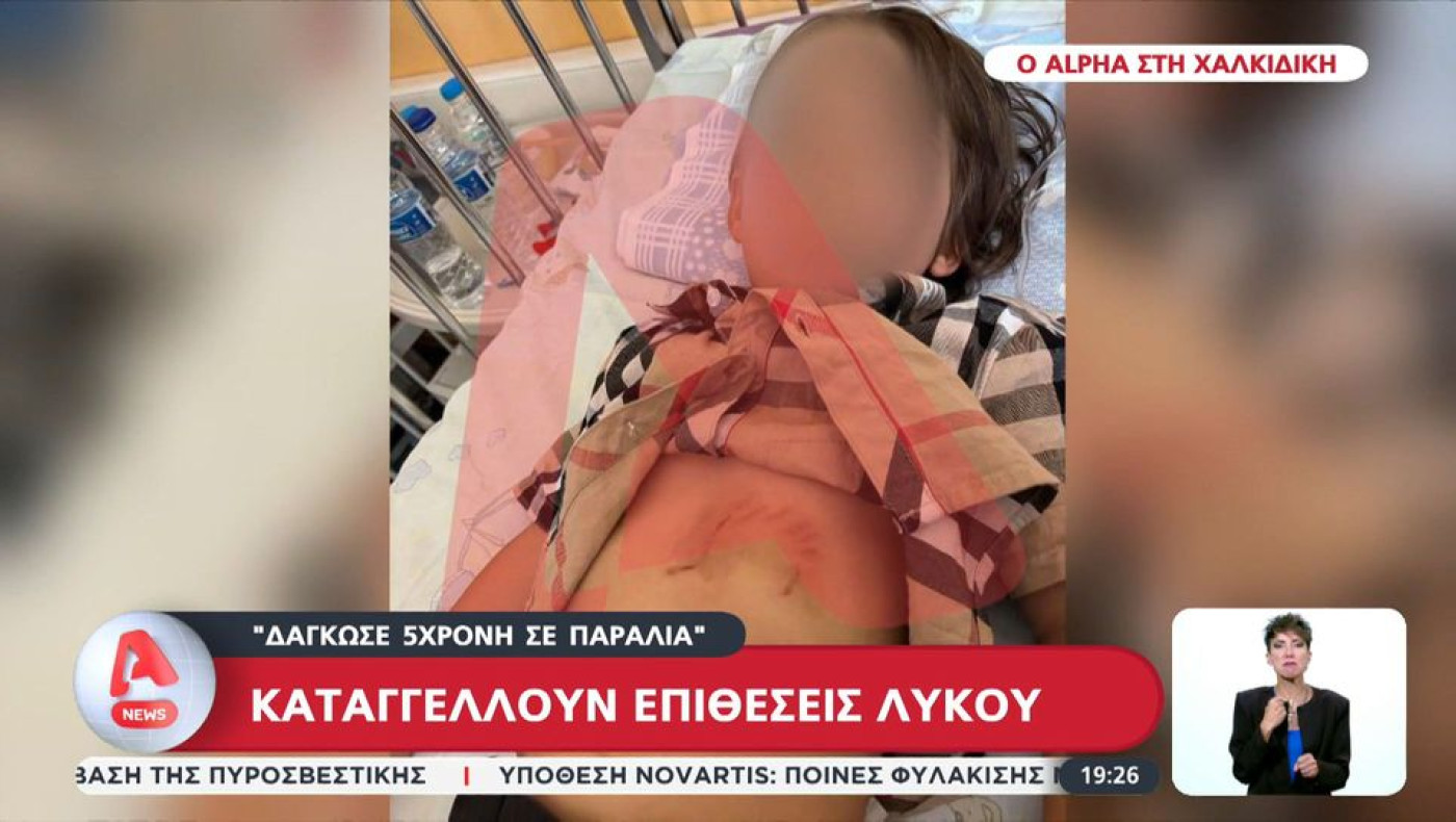 Χαλκιδική-Καταγγελία για επίθεση λύκου: «Δάγκωσε 5χρονη σε παραλία!»