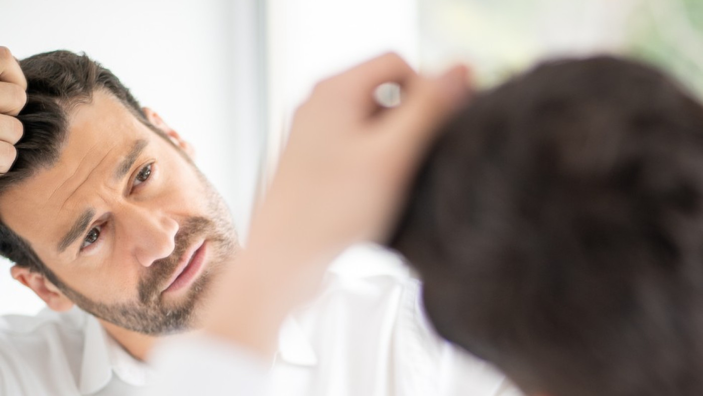 Είναι ταμπού η μεταμόσχευση μαλλιών;