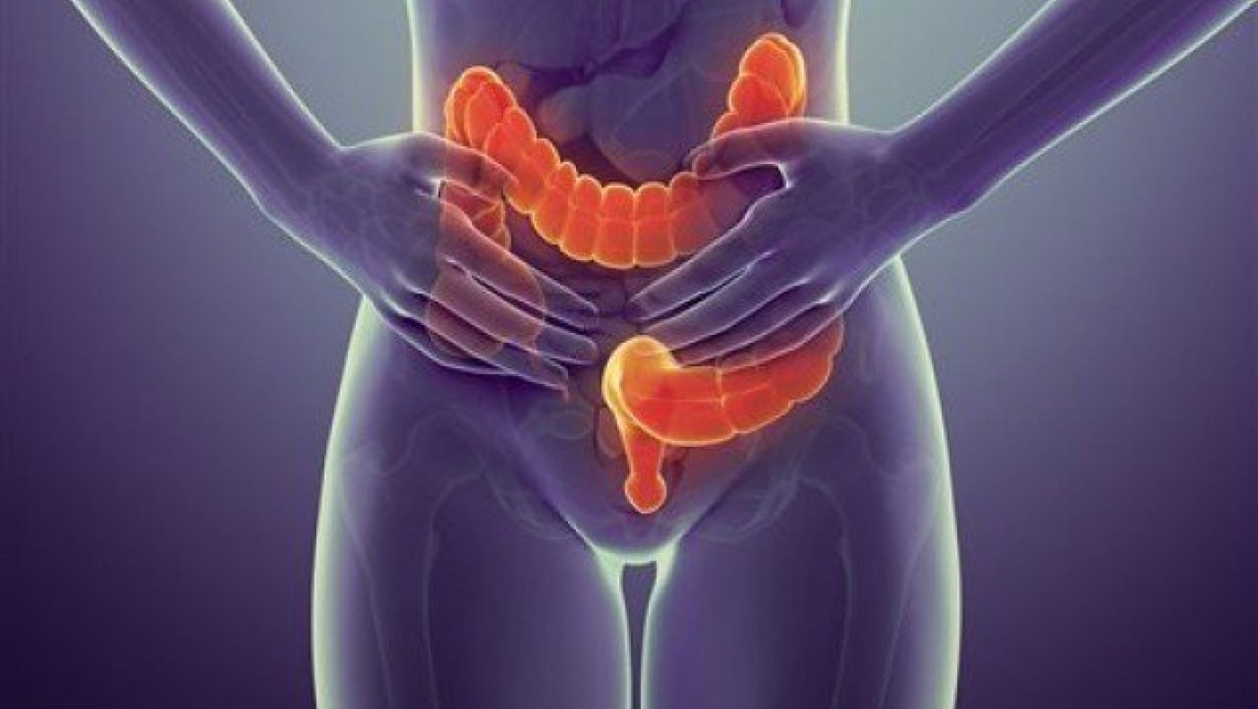 Ανακαλύφθηκε με τι σχετίζεται ο καρκίνος παχέος εντέρου σε νέα άτομα