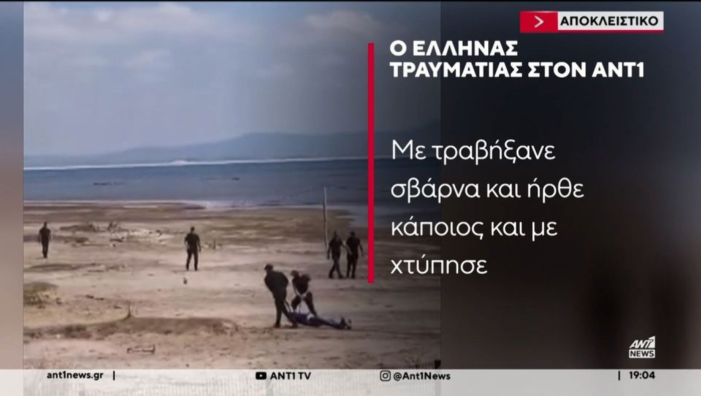 Επεισόδια στην Αλβανία: «Ήθελαν να με αποτελειώσουν εκεί»