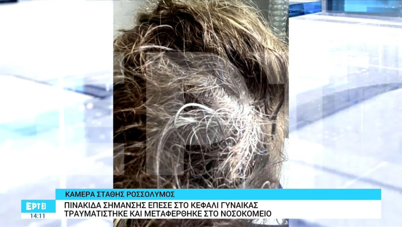 Θεσσαλονίκη: Της ήρθε πινακίδα στο κεφάλι ενώ περπατούσε στο πάρκο Ξαρχάκου