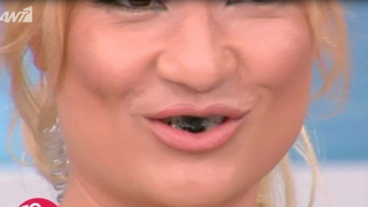 Με... μαύρα δόντια η Φαίη       Σκορδά στο «Πρωινό»! (ΒΙΝΤΕΟ)