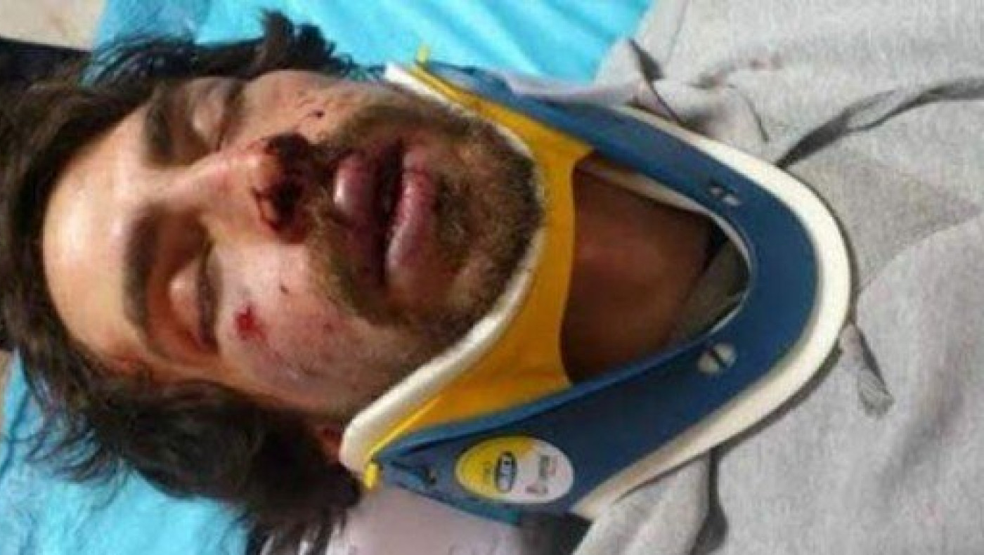 7ετή κάθειρξη σε υπάλληλο του Μιχαλολιάκου για τον ξυλοδαρμό φοιτητή