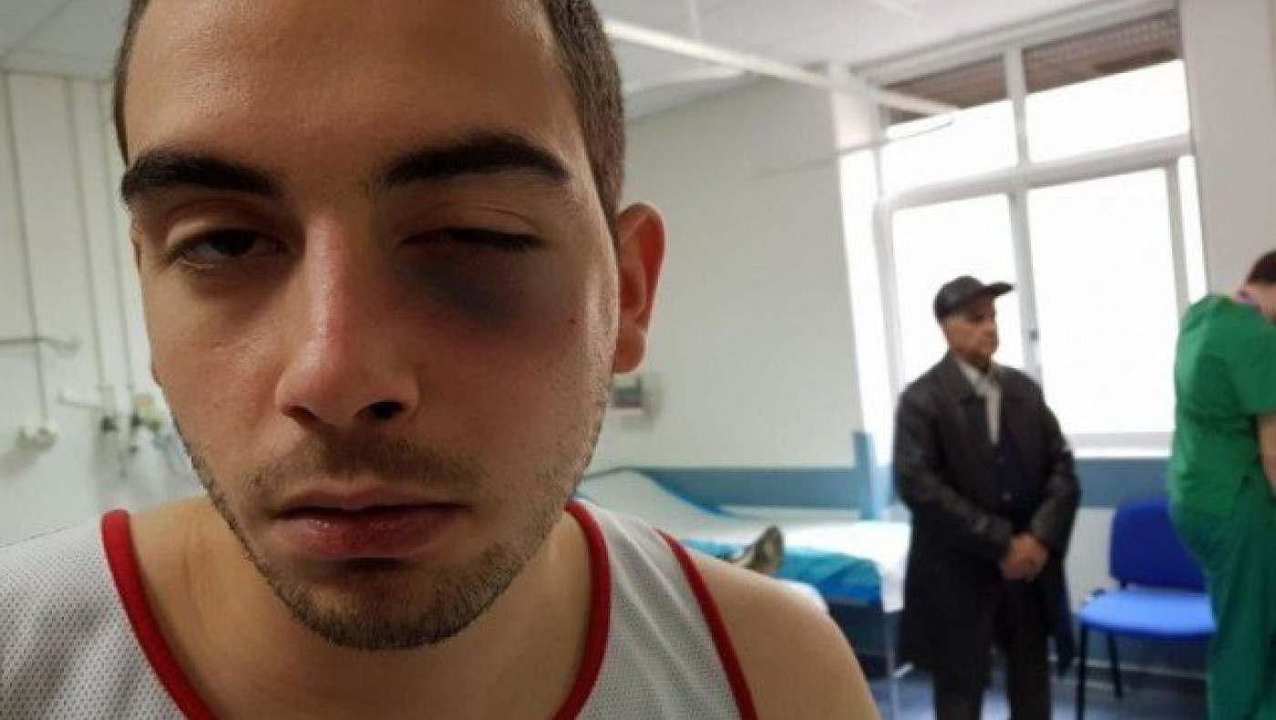 Γυμναστής γρονθοκόπησε 21χρονο επειδή διαφώνησαν για... άσκηση! (ΦΩΤΟ)