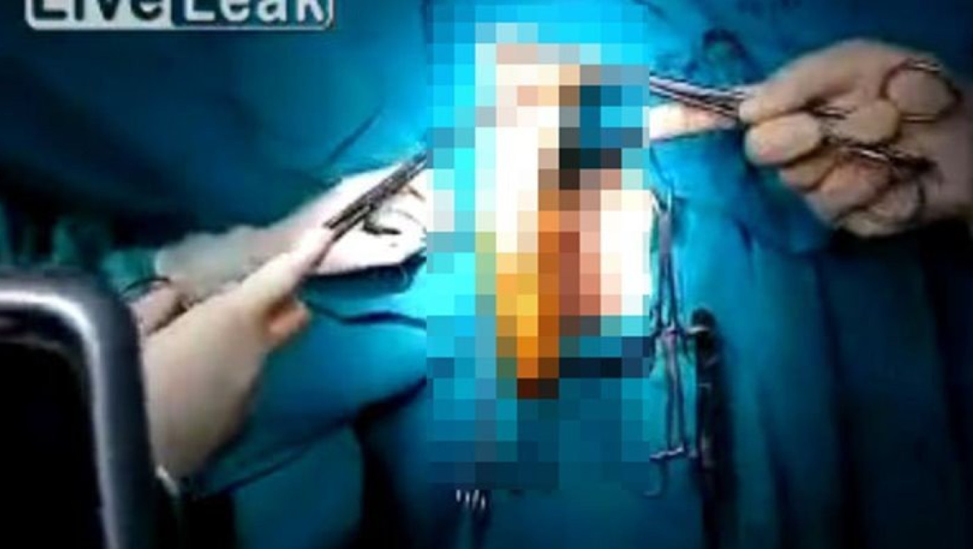 Επαιζε με sex toys και κατέληξε στο νοσοκομείο