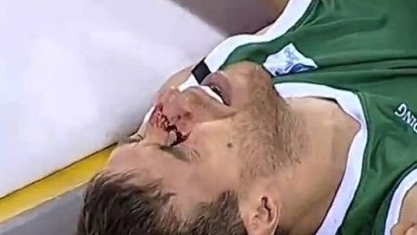 Άσχημος τραυματισμός του Βάθκεθ σε προσπάθειά του να καρφώσει (VIDEO)