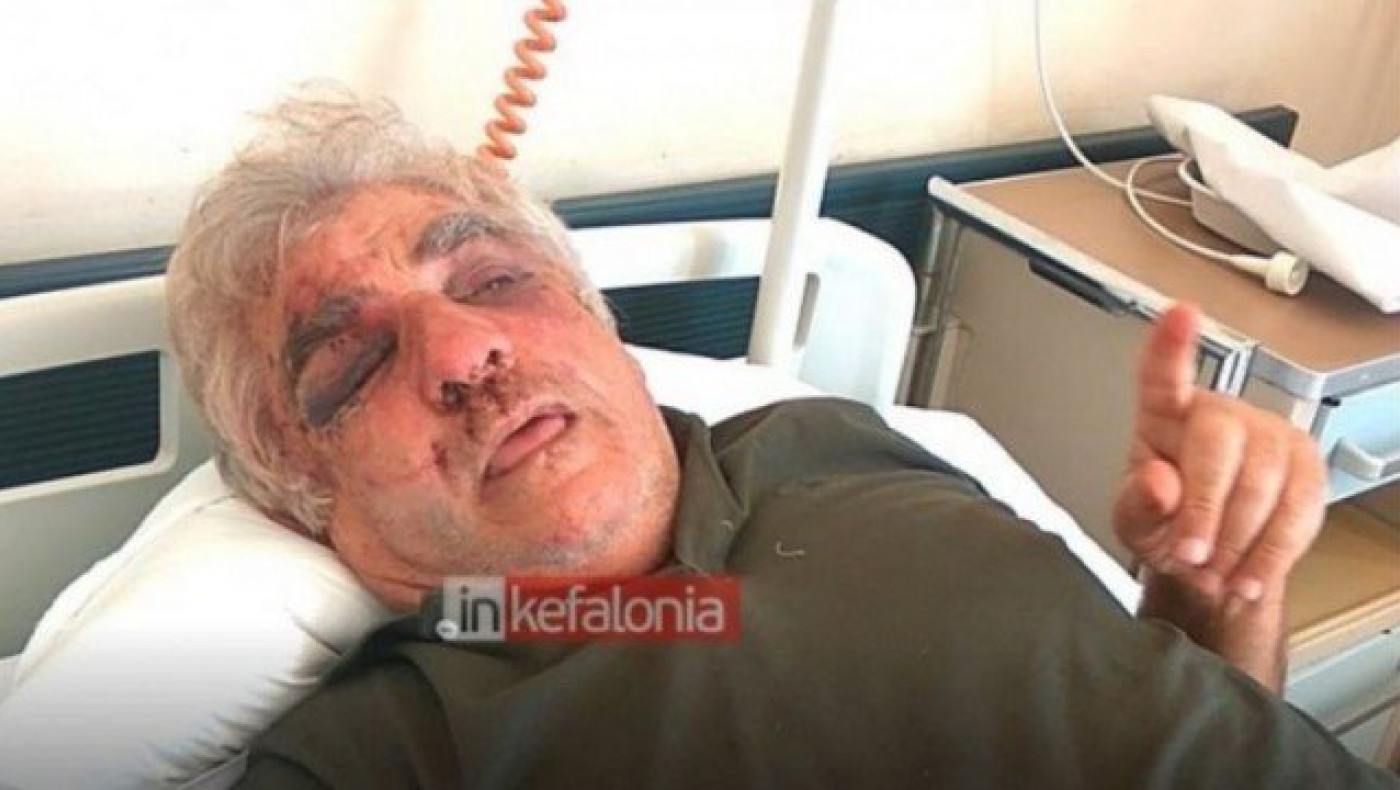 ΣΟΚ: Απίστευτη αγριότητα σε ληστεία στην Κεφαλονιά (ΒΙΝΤΕΟ)