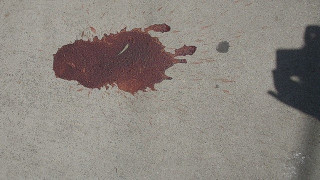 ΙΧ παρέσυρε γυναίκα στη Θεσσαλονίκη - ΠΡΟΣΟΧΗ ΣΚΛΗΡΕΣ ΕΙΚΟΝΕΣ