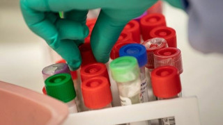 Επιστημονική κοινότητα: Αφήστε τη χλωροκίνη, θα σας σκοτώσει