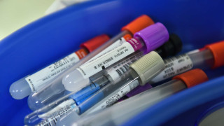 Πότε θα ξεκινήσουν τα μαζικά τεστ για κορωνοϊό στην Ελλάδα