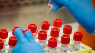 Κορωνοϊός: 15 νέα κρούσματα και ένας θάνατος