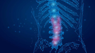 Το σύνδρομο που απειλεί τη σπονδυλική στήλη και πώς αντιμετωπίζεται