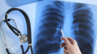 Απίστευτο περιστατικό: Πήγε για ακτινογραφία σε κτηνίατρο λόγω βλάβης στο νοσοκομείο