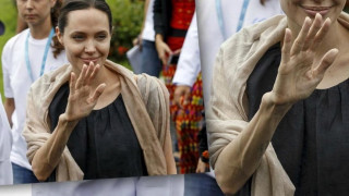 Σοκαριστικές φωτογραφίες: Το αποστεωμένο χέρι της Τζολί (pics) 