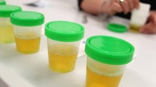 Ντοπέ 28 αθλητές από το 2005 και το 2007