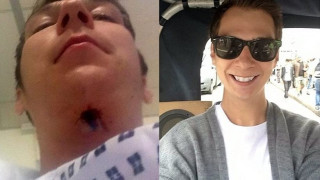 Ήθελε κάτασπρα δόντια και κατέληξε με... μια τρύπα στο λαιμό του