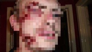 Άγρια επίθεση δέχτηκε γνωστός Έλληνας τραγουδιστής!