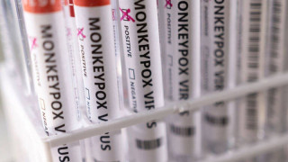 Ευλογιά των πιθήκων-Συμπτώματα: Τι άλλαξε σε σχέση με προηγούμενες εξάρσεις της νόσου