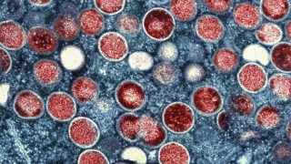 Ισραήλ: Σπάνια αμοιβάδα οδήγησε 36χρονο στον θάνατο από ναιγλερίαση