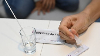 Ελλάδα: Κατά 19% μειώθηκαν τα κρούσματα κορωνοϊού την εβδομάδα 1-7 Αυγούστου