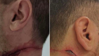 Αστυνομικοί δέχθηκαν επίθεση: «Μας ράντισε με ούρα και μας χαράκωσε στον λαιμό»