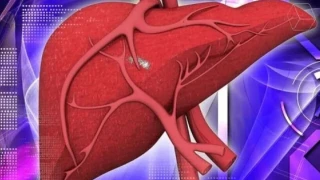 Ήπαρ: Το γλυκαντικό που αυξάνει τον κίνδυνο καρκίνου και κίρρωσης