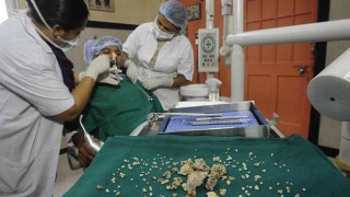 Έβγαλαν 232 δόντια από στόμα Ινδού (pics)