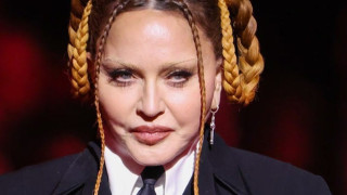 Η Μαντόνα απαντά στα σχόλια για τo φουσκωμένο πρόσωπό της στα Grammy: «Υποκλιθείτε σκύλες»