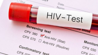 AIDS: Ένας στους 10 Έλληνες που είναι φορείς δεν το γνωρίζει