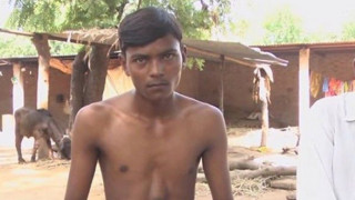 ΑΠΙΣΤΕΥΤΟ: Αγόρι ζει με καρδιά έξω από το στήθος (pic)