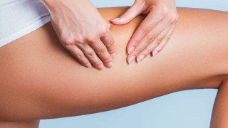 Κυτταρίτιδα: Μύθοι και αλήθειες που πρέπει να γνωρίζουμε-Αιτίες και θεραπείες (vid)