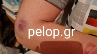 Πλάκωσε στο ξύλο την πρώην και συνελήφθη: «Θα σε σκοτώσω όταν βγω»