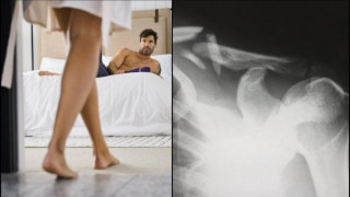 Έσπασε σε τρία σημεία το μόριό του κατά την διάρκεια της ερωτικής πράξης