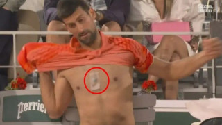 Τζόκοβιτς: Η νανοτεχνολογία στο... στήθος του, που τον κάνει «Iron Man»