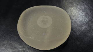 Απίστευτο περιστατικό ζήλειας: Τρύπησε τις σιλικόνες στο στήθος της πρώην του, επειδή το «άγγιζε άλλος»