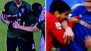 Έπαθε Σουάρες ο Φοφανά: Δάγκωσε αντίπαλο του σε αγώνα στην Τουρκία!