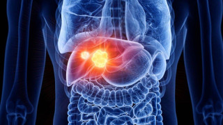 Από Δανία στην Ελλάδα: Δότης σπέρματος με... καρκινογόνο μετάλλαξη-Πέθανε παιδάκι!