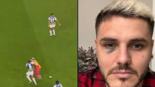 Τουρκία: Ο Ικάρντι δέχθηκε μπουνιά στο πρόσωπο, αλλά ο διαιτητής δεν καταλόγισε πέναλτι