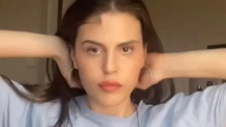 Της «φύτρωσαν» μαλλιά στο μέτωπο: «Μου αρέσουν, δεν θα τα ξυρίσω ποτέ»