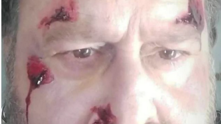 Θύμα τροχαίου ο ηθοποιός Κωστής Σαββιδάκης-Η ανάρτηση της οργής με τα τραύματα: «Σκοτώνετε κόσμο»