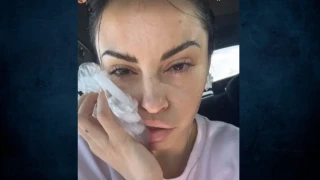 Ατύχημα στον δρόμο έπαθε η Δήμητρα Αλεξανδράκη-«Προσγειώθηκε η μπάρα στο κεφάλι μου»