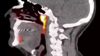 Οι επιστήμονες ανακάλυψαν τυχαία ένα νέο όργανο στο ανθρώπινο σώμα