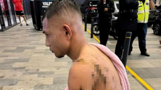 ΣΟΚ στη Μαλαισία! Στην εντατική διεθνής ποδοσφαιριστής μετά από επίθεση με καυστικό οξύ!