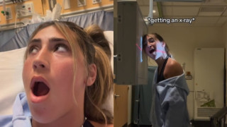 Κοπέλα χασμουρήθηκε τόσο δυνατά που το σαγόνι της «μπλόκαρε», με το στόμα της να μένει ορθάνοιχτο