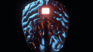 Έλον Μασκ: Άσχημα νέα για το εγκεφαλικό τσιπάκι - Ποιες δυσλειτουργίες παρουσίασε