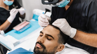 Μεταμόσχευση Μαλλιών: Η τριχόπτωση δεν είναι ανίκητη!